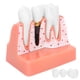 thumbnail image 5 of Modelo de dientes Análisis de implantes dentales Modelo de puente de corona Modelo de diente de demostración, 5 of 14