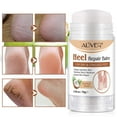 thumbnail image 2 of Aliver Heel Repair Balm For Dry & Cracked Feet, Coconut Scent - with Shea Butter and Olive Oil - Soften Dry Feet - Hydrates & Repair Skin for Rough Skin, 2 of 9
