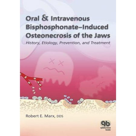 Oral and Intravenous Bisphosphonate-Induced Osteonecrosis of the Jaws : History, Etiology, Prevention, and Treatment, Used [Paperback]