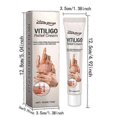 thumbnail image 5 of Vitiligo Relief Cream, Natural Cream For Vitiligo Treatments, Portable Anti-itch Body Care Cream Skin Care Products, 5 of 5