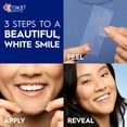 thumbnail image 6 of Crest 3DWhitestrips Pro-Level Whitening At-Home Whitening Kit, 20 Treatments, 12 Levels Whiter Teeth, 6 of 10