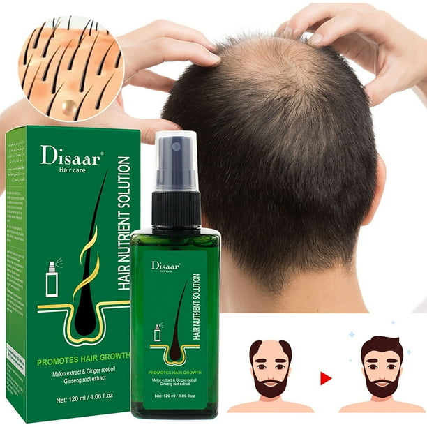 Fiudx Sueros En Crecimiento Del Cabello, Revitalizados En Cuero Cuero, Sprays Nutritivos, Cabello, Repollo, Hombres y Mujeres, 5 Hogares En Vida, Solución de Uso Diario.