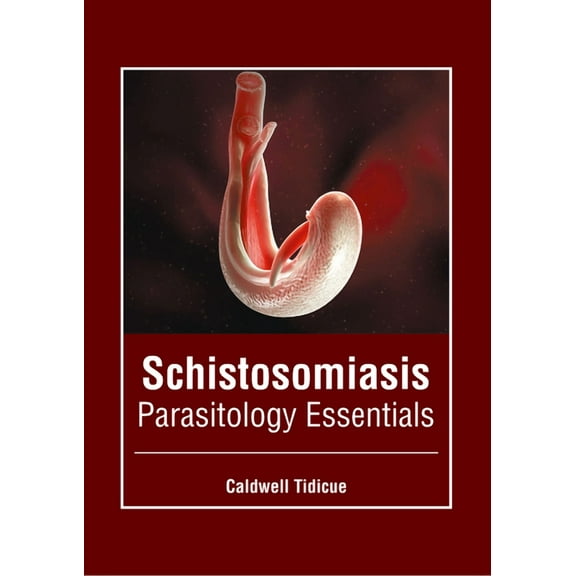 Schistosomiasis: Parasitology Essentials, (Hardcover)