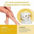thumbnail image 4 of Anti-Varicose Soothing Cream with Bee-Venom, Vitamin K Formula for Varicose & Spider Veins Relief, 1/2/3PCS, 4 of 5