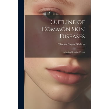 Outline of Common Skin Diseases: Including Eruptive Fevers (Paperback)