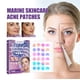 thumbnail image 1 of JAYSUING Colorful Hydrocolloid Acne Patch (144 pieces), 1 of 9