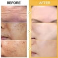 thumbnail image 2 of Crema blanqueadora de pecas, puntos negros, melasma, antimanchas, aclara la pigmentación, hidratante, productos coreanos para el cuidado de la piel, 2 of 6