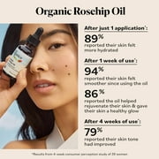 Sky Organics Organic Rosehip Oil to Rejuvenate and Brighten Face, 1 fl oz