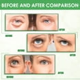 thumbnail image 3 of Jumpingount 30 unids/caja de parches para los ojos de círculo oscuro a base de hierbas, suministro de belleza para eliminar la hinchazón, Cuidado de ojos, 3 of 6