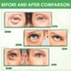 thumbnail image 3 of Seitruly 30 unids/caja de parches para ojos de círculo oscuro a base de hierbas, eliminación de arrugas de línea fina, belleza nutritiva, Cuidado de ojos, 3 of 6
