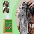 thumbnail image 2 of Batana Oil Shampoo, Shampoo De Batana, Rosemary Oil Shampoo, Batana Shampoo With, 2 of 5