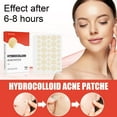 thumbnail image 2 of Maojin Parche hidrocoloide para el acné, maquillaje, parche para el acné con boca cerrada, 2 of 3