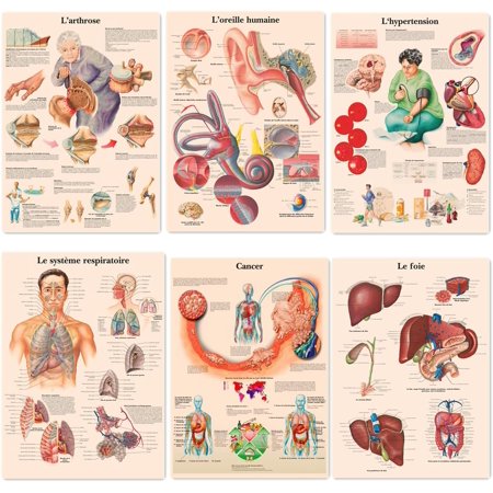 Human Ear, Respiratory System, Liver, Cancer, Hypertension, Arthritis French Posters 6 PCS Human Anatomy Prints Vintage Kraft Paper Wall Art Painting Hospital Clinic Room Home Decor,11.8X16.5 inch