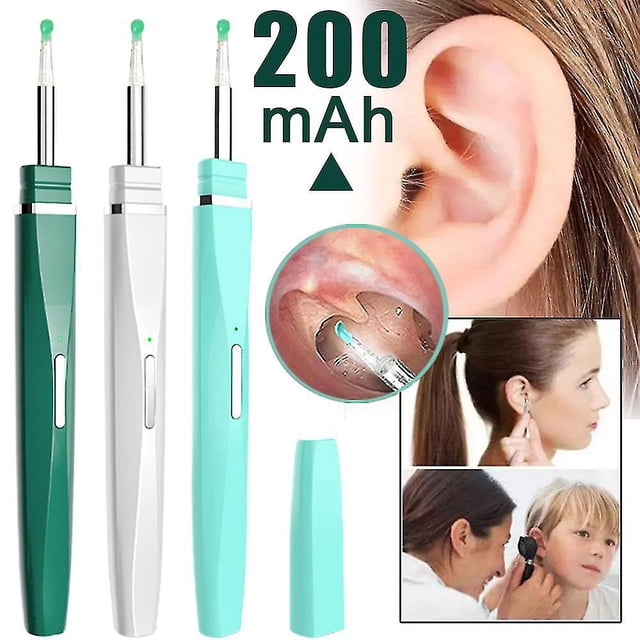 Removedor de cera de oído inteligente con luces, cámara Wifi, endoscopio de oído inalámbrico de alta definición, cuchara para recoger, otoscopio de limpieza