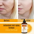 thumbnail image 5 of Dermaxgen® PURE ORGANIC Vitamin C 20% + Retinol + Hyaluronic Acid ANTI-AGING SERUM - 8 FL OZ, 5 of 8