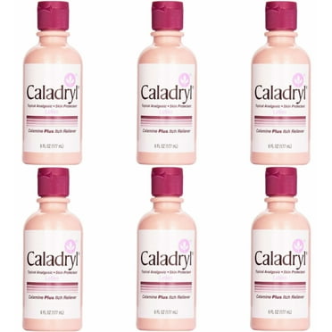 Caladryl Skin Protectant Lotion, Calamine + Itch Reliever, 6 fl oz ...