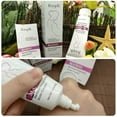 thumbnail image 2 of Stretch Mark Removal Cream Repair Scars Stretch Marks Remove Pregnancy Scar Cream, 2 of 5
