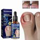 thumbnail image 1 of Professional Foot Anti-fungal Treatment Solution To Remove Onychomycosis Care Repair Liquid Healthy Nail Care Repair Liquid, 1 of 4