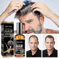 thumbnail image 3 of Ginger Hair Growth Oil 30ml -, 3 of 4