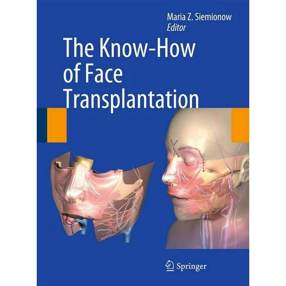 The Know-How of Face Transplantation, (Hardcover)