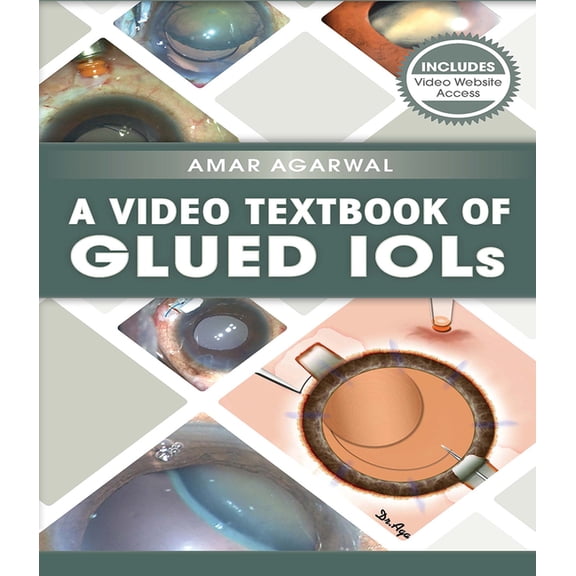 A Video Textbook of Glued Iols, (Paperback)