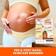 thumbnail image 2 of Kit de cuidado corporal Palmer's Vitamin E Mom's Skin Healing, 2 of 9