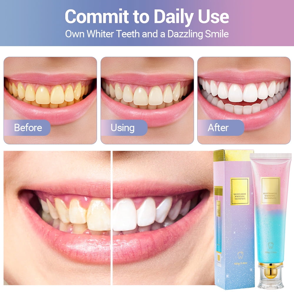 Niacinamide Whitening Toothpaste, Oral Care Fresh Breath Toothpaste, Adult Nicotinamide Toothpastes Remove Surface Stains (3.8 oz, 3Pcs)