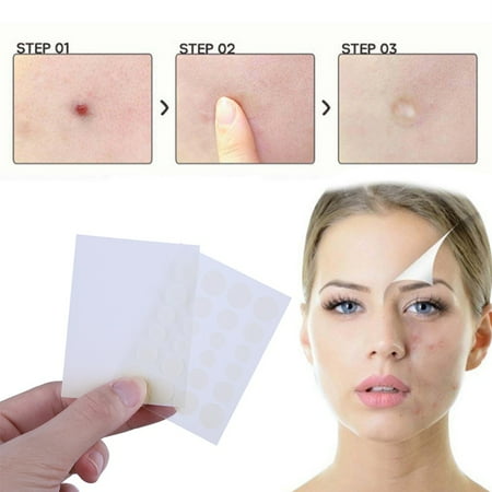 SUPERHOMUSE 24Pcs Acne Pimple Patch Little Stickers Patch Acne Treatment...