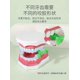 thumbnail image 4 of Aligner Chewies, 4 PCS Y-Shaped Orthodontics Aligner Chewies for Trays Seater Invisible Braces Orthodontic Munchies(Blueberry, Watermelon, Mint, Grape, 4 of 5