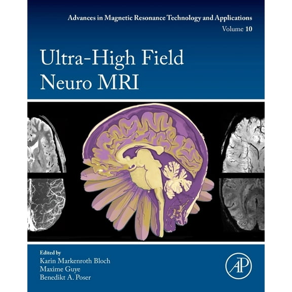 Advances in Magnetic Resonance Technolog Ultra-High Field Neuro MRI: Volume 10, Book 10, (Paperback)