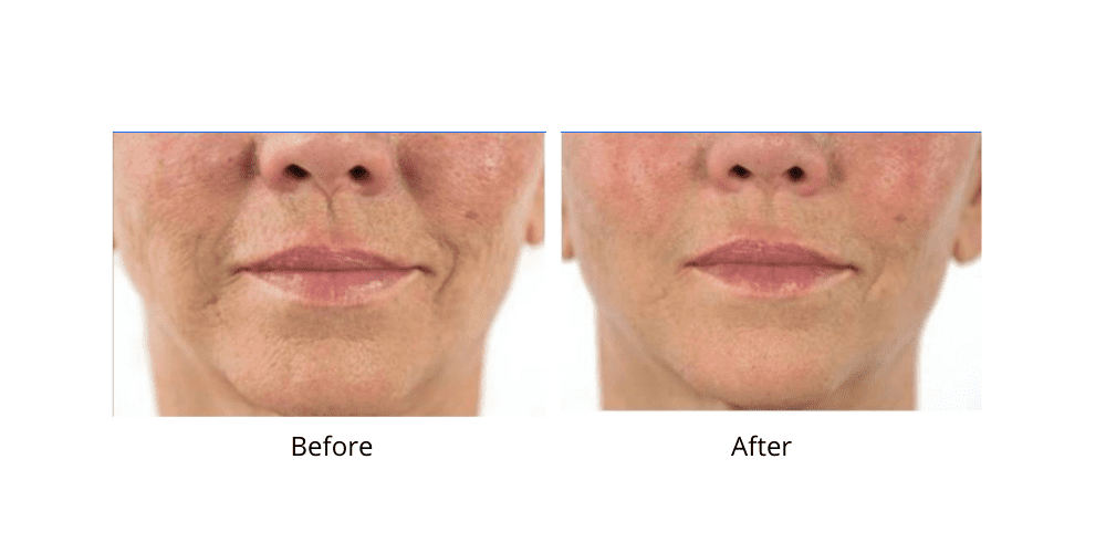 Dr. Sevinor’s NEW Genuine Facelift Solution Concentrated Serum Jumpstarts Tired Looking Skin, Diminishes Wrinkles/Lines Renews Skins Elasticity