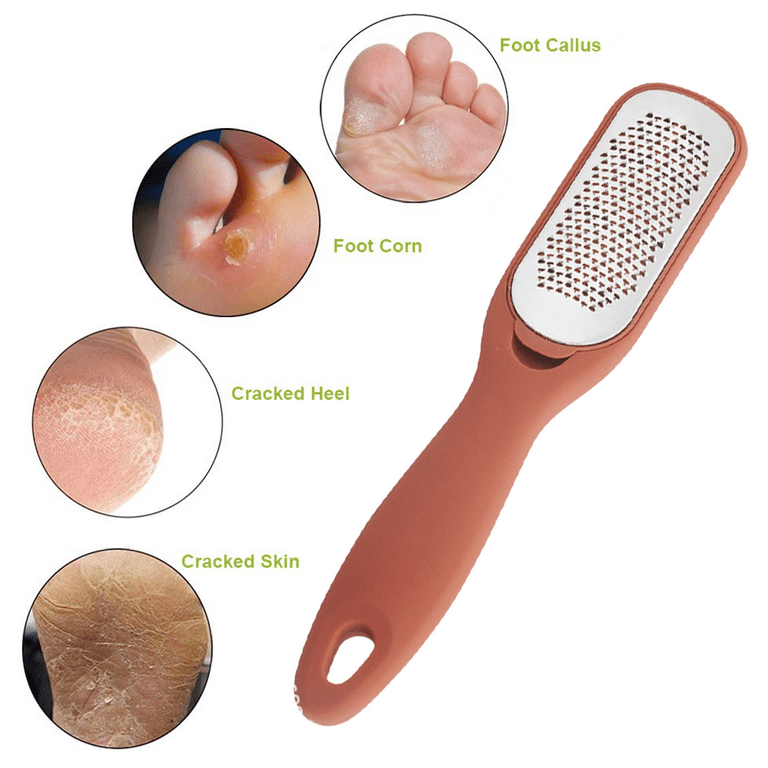 Foot File Callus Remover,Colossal Foot Rasp and Vietnam