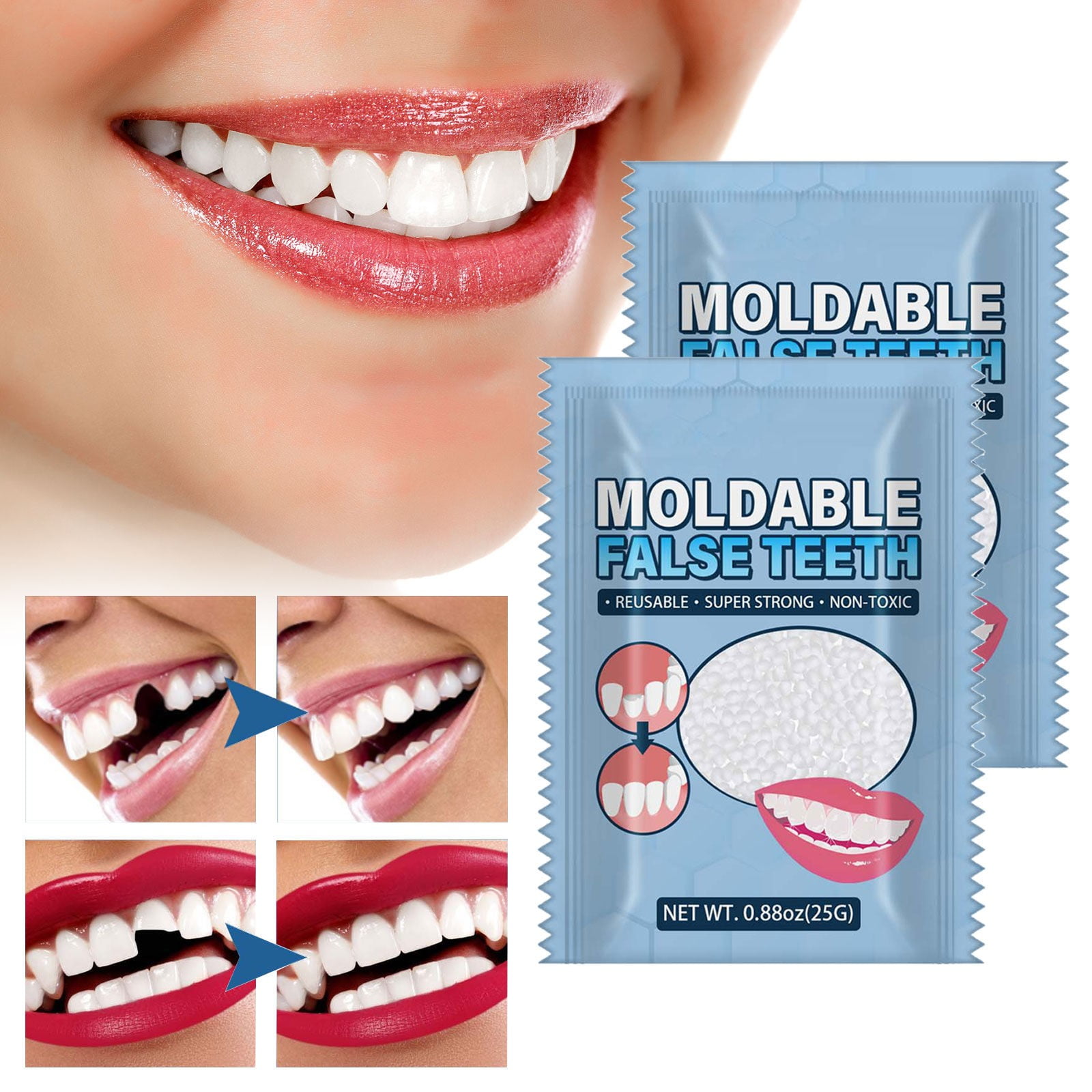 NIUREDLTD Teeth Glue Makeup Dentures Modified Temporary Filling Teeth  Filling Teeth Glue Filling Holes Broken Teeth(1/2/3pcs) 