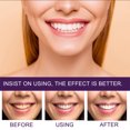 thumbnail image 2 of Limpieza Dientes Dentifrice Tooth Cleaning Mousse, 2 of 9
