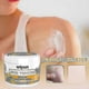 thumbnail image 2 of 3Pcs Psoriasises Cream, Bee-venom Psoriasises Cream Skin Relief Anti-itch Cream Skin Care Products, 2 of 5