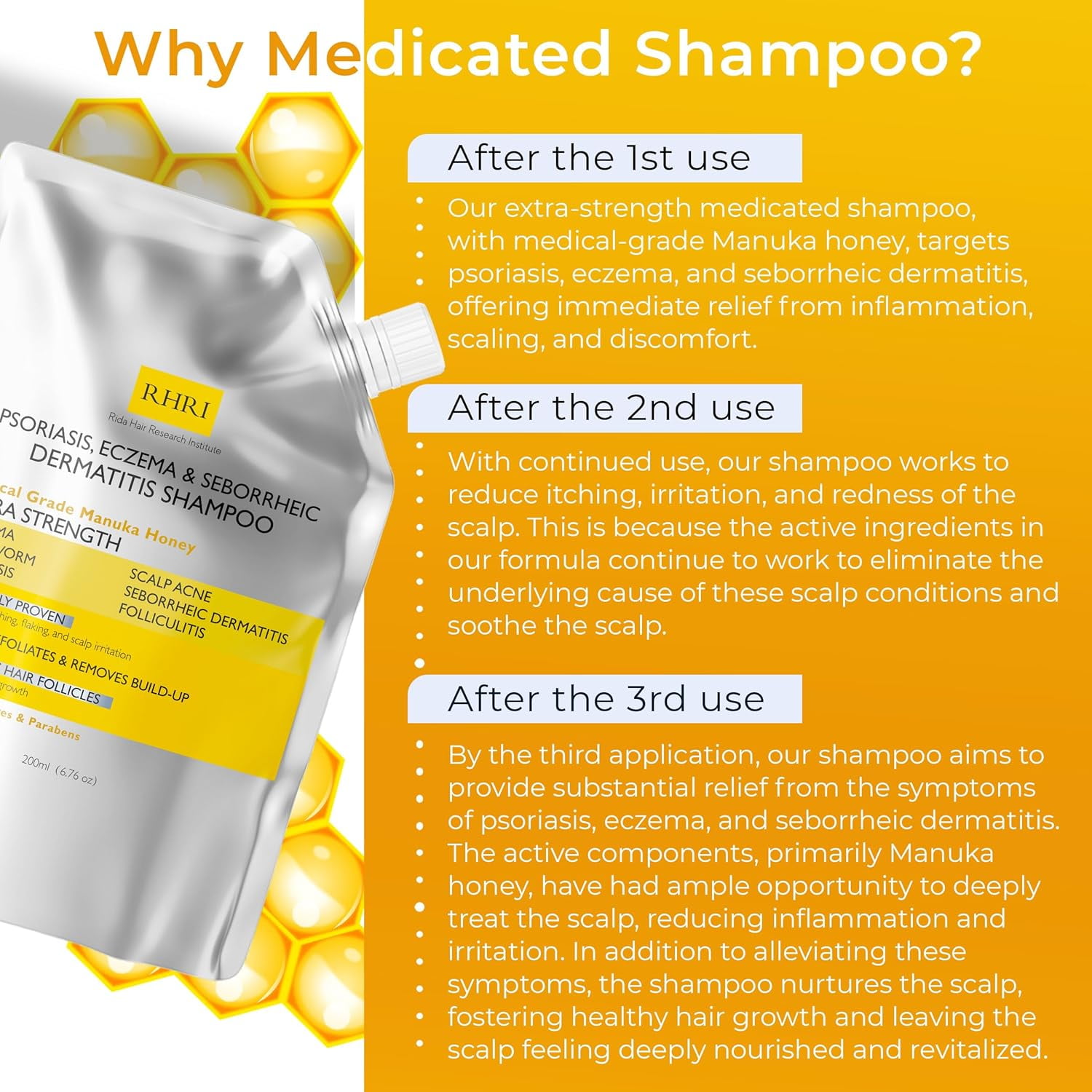 Antifungal Psoriasis Shampoo, Eczema, Shampoo, Seborrheic Dermatitis Shampoo