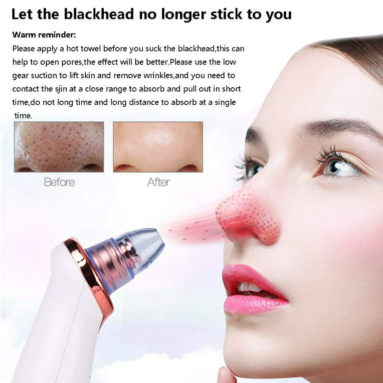 Blackhead Remover Vacuum,Upgraded Facial Pore Cleaner,Electric Acne  Comedone Whitehead Extractor Tool-5 Suction Power,Usb Rechargeable Blackhead  Vacuum Kit For Women & Me - Walmart.Com