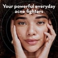 thumbnail image 3 of Parches para espinillas LE GUSHE K-BEAUTY para rostro (132 puntos), 3 of 8