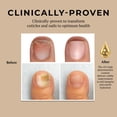 thumbnail image 4 of Aceite para cutículas Miracle Fruit Oil 10 ml fortalecedor de uñas, 4 of 7