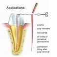 thumbnail image 1 of Percha 200 Pcs / Boîte Pointes de Gutta Percha Matériau de Remplissage de Canal Racinaire Endodontique, 1 of 8