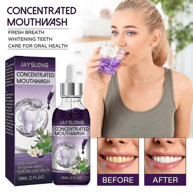 Enjuague bucal concentrado Jaysuing para mal aliento, manchas en los dientes, limpieza de dientes amarillos, boca fresca, enjuague bucal blanqueador de dientes BF |