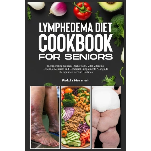 Lymphedema Diet Cookbook for Seniors: Incorporating Nutrient-Rich Foods, Vital Vitamins, Essential Minerals, and Beneficial Supplements Alongside Therapeutic Exercise Routines. (Paperback)