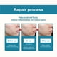 thumbnail image 4 of Love Star Shaped Acne Patch 72 Concealer Acne Patch Patch, 4 of 5