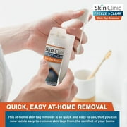 Skin Clinic FREEZE n CLEAR Skin Tag Remover