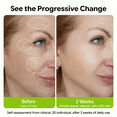 thumbnail image 4 of Jtopyrt The Vita A Retinal Shot Tightening Booster 0.1% Retinal for Pore Minimizing, Wrinkles & Fine Lines, Firmer Skin 15ml, 4 of 8