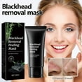 thumbnail image 4 of Mascarilla facial para eliminar puntos negros con ingredientes naturales que penetran fácilmente en los poros y eliminan los puntos negros., 4 of 9