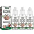 thumbnail image 1 of 3pcs EELHOE Anti Fungal Treatment Fungus Effective Finger Toe Nail Repair Li, 1 of 5