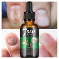 thumbnail image 2 of 7 Days Nail Fungus Treatment, Ginger Nail Growth Strengthening Serum, Nail Repair Solution, Restoring Healthy Nails Cuticles Oil Ginger Nail Oil, 2 of 5