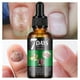 thumbnail image 2 of 7 Days Nail Fungus Treatment, Ginger Nail Growth Strengthening Serum, Nail Repair Solution, Restoring Healthy Nails Cuticles Oil Ginger Nail Oil, 2 of 5