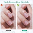 thumbnail image 3 of EXLEAF Nail-Stainless Steel Cuticle Trimmer for Dead Removal in Manicure Pedicure Grooming Kit Nail Care Tool, 3 of 9